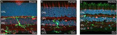 The Contribution of Microglia to the Development and Maturation of the Visual System